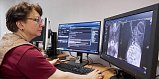 Новая нейросеть начала искать признаки семи заболеваний на КТ москвичей